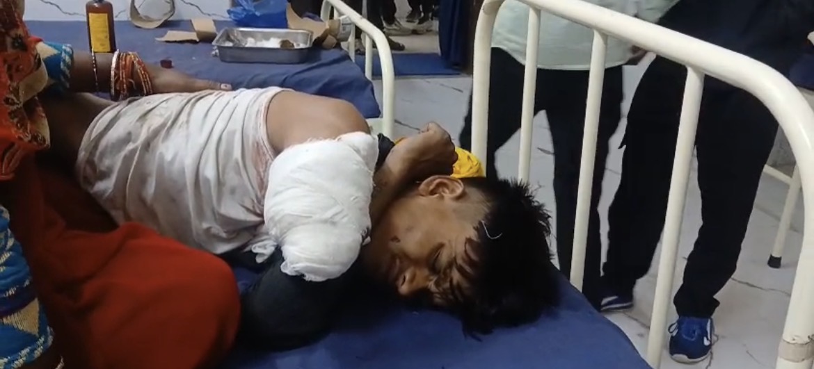 चलती ट्रेन की चपेट में आया बालक, हाथ कटा, हायर सेंटर रेफर, नशे के लिए परिजनों से मांग रहा था पैसे